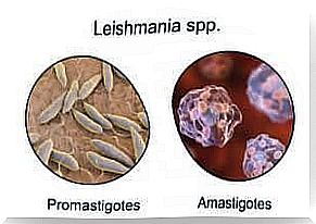 Insect bites - leishmaniasis