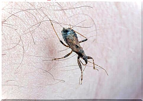 Triatoma Infestans predatory bug stings