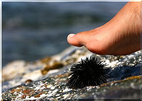 What to do if you have been stung by a sea urchin